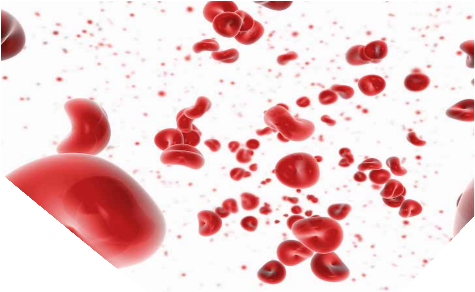 Change to HbA1C reporting in the presence of a Haemoglobin variant.